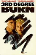 Watch Third Degree Burn 123MovieFree