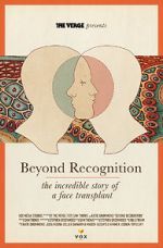 Watch Beyond Recognition: The Incredible Story of a Face Transplant 123MovieFree