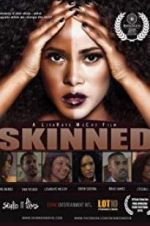 Watch Skinned 123MovieFree