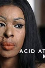 Watch Acid Attack: My Story 123moviesfree